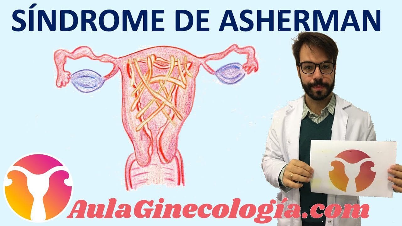 Como-manejar-el-sindrome-de-Asherman - Sonajero.es Cómo manejar el síndrome de Asherman