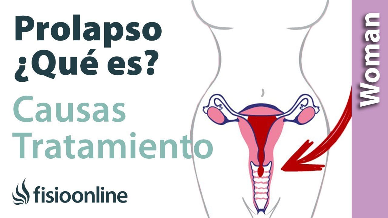 Todo-sobre-los-tratamientos-para-el-prolapso-uterino - Sonajero.es Todo sobre los tratamientos para el prolapso uterino