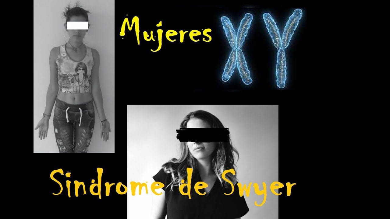 Cómo manejar el síndrome de Swyer